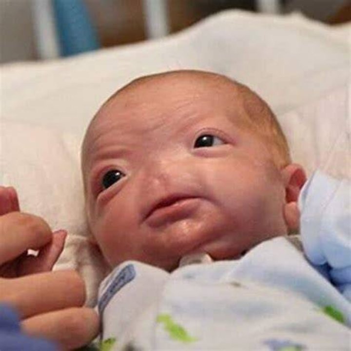 Can a baby be born without a bladder