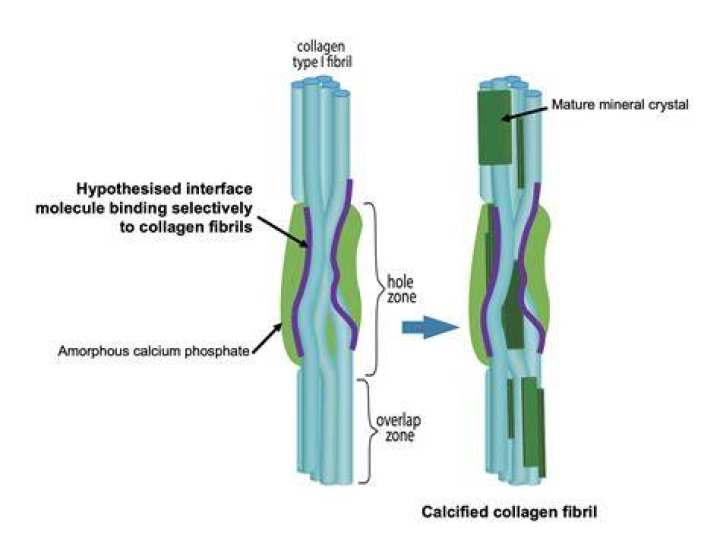 Can bone calcification be reversed
