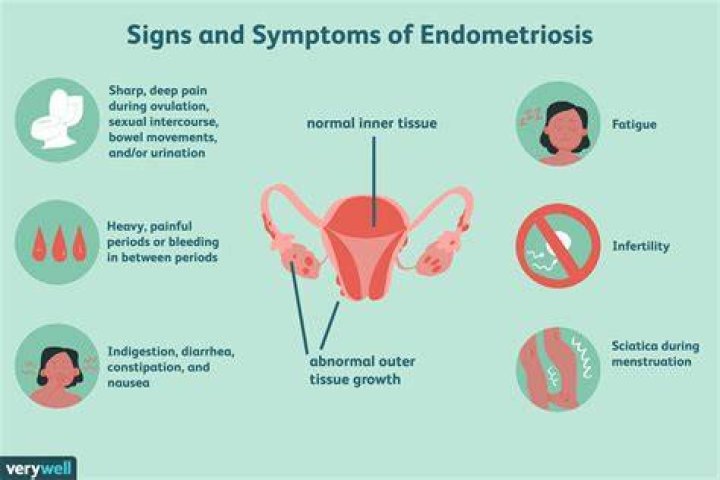 Can Homeopathy treat endometriosis