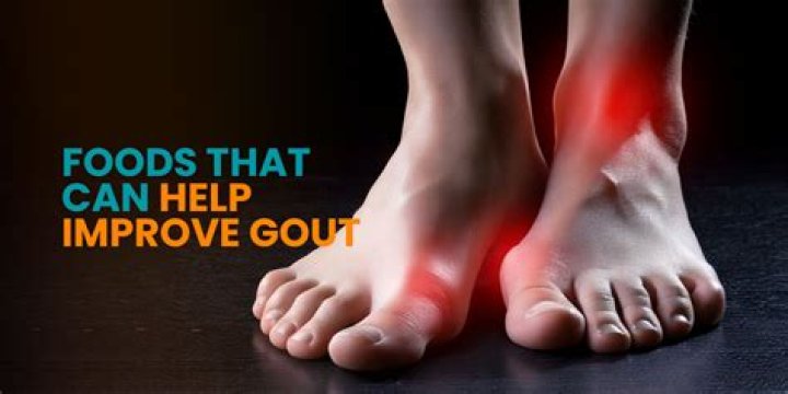 Can losing weight trigger gout