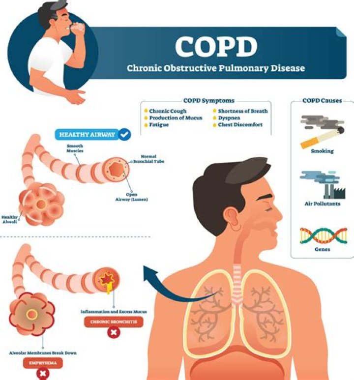 Can oxygen make COPD worse