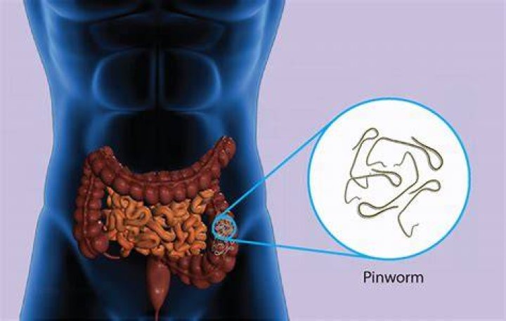 Can pinworm medicine make you sick