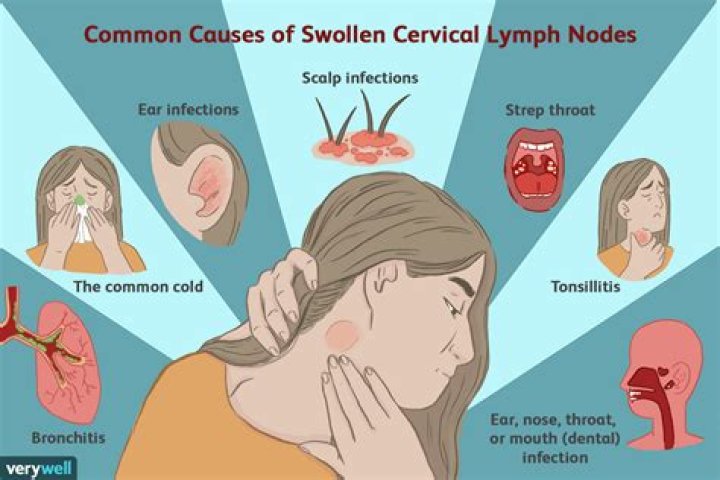 Can teething cause lymph nodes to swell