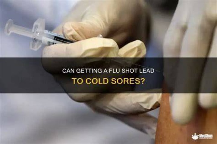Can the flu shot give you a cold sore