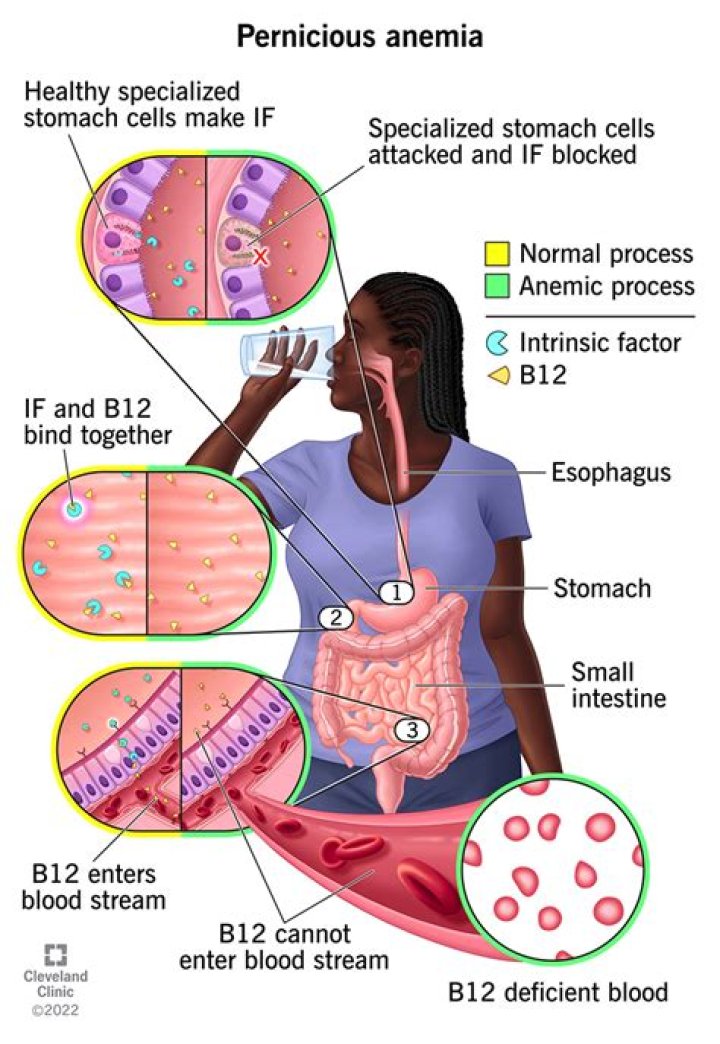 Can vitamin b12 cause abdominal pain