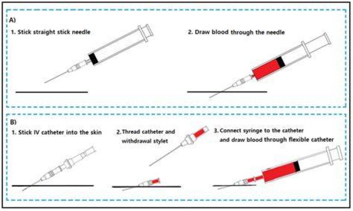 Can you draw below an IV