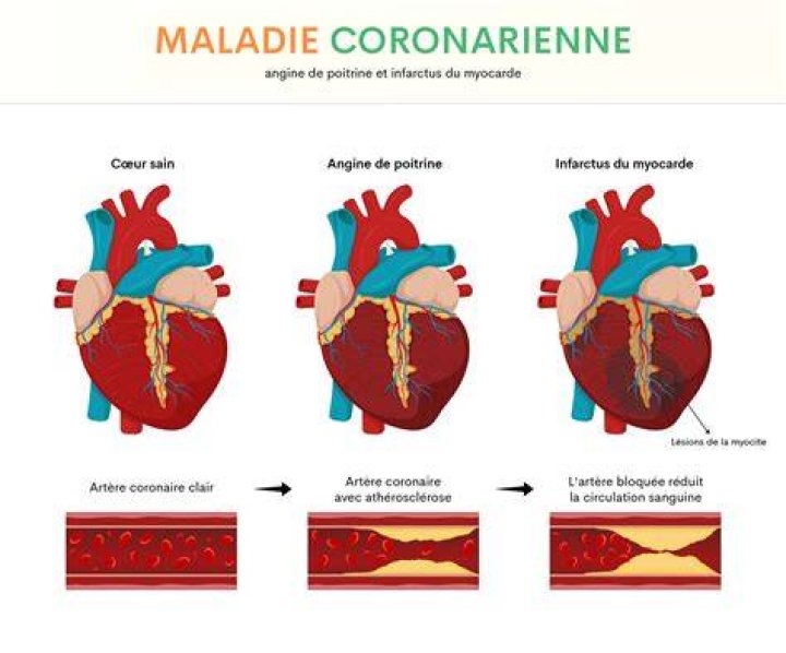 Cest quoi une crise dangor