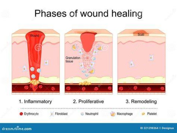 Does inflammation repair damaged tissue