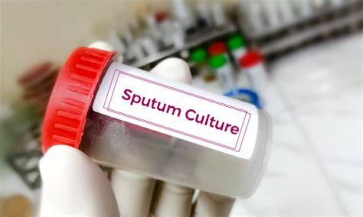 How accurate are sputum cultures