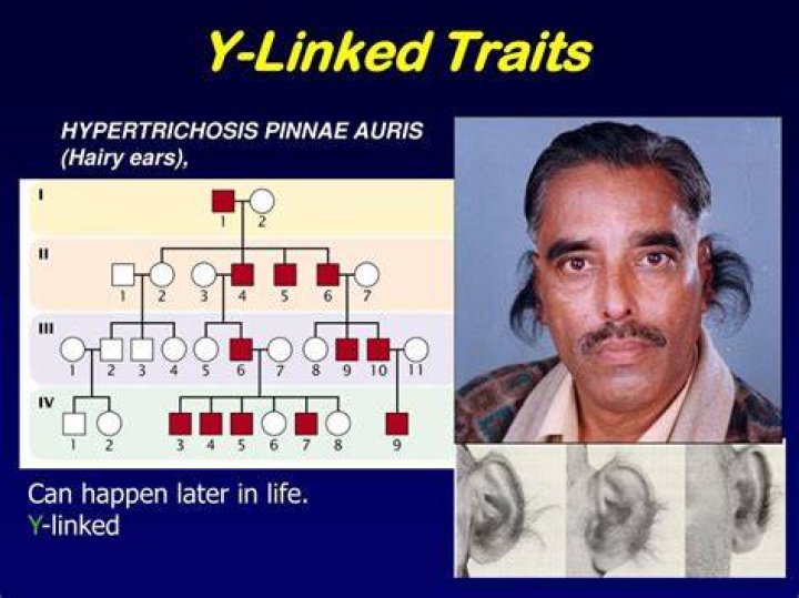How are hairy ears inherited