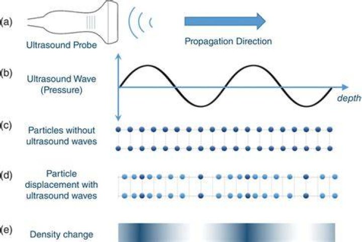 How are waves used in ultrasound