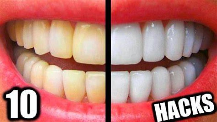 How can I whiten my bottom teeth