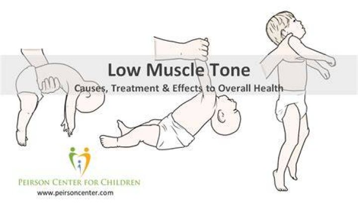 How do you assess newborn tone