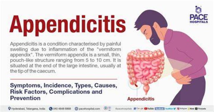 How do you feel when you have appendicitis