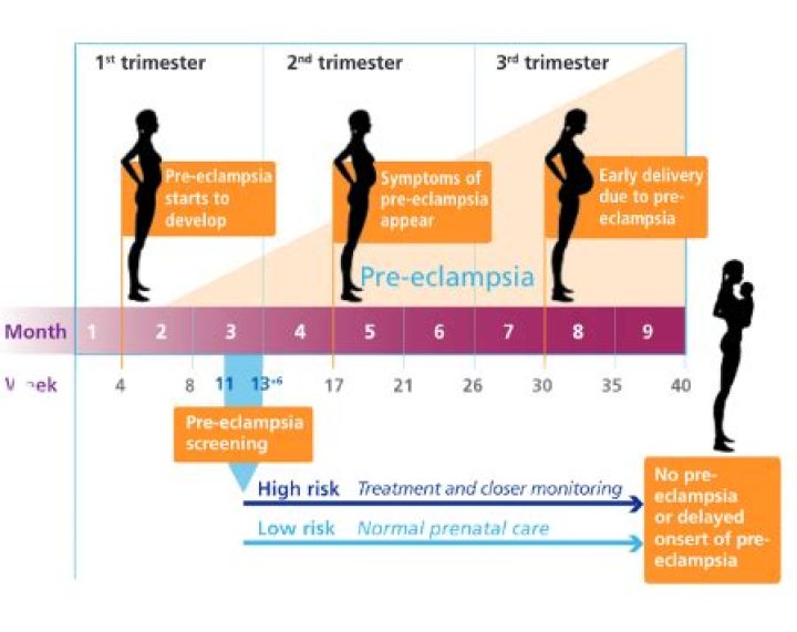 How fast can preeclampsia develop