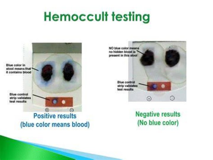 How is a Hemoccult test performed
