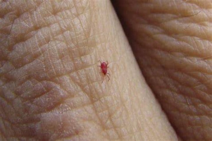 How long do chiggers live on your skin