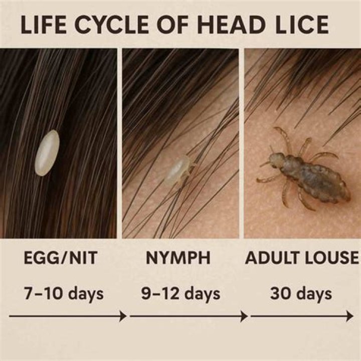 How long do head lice live