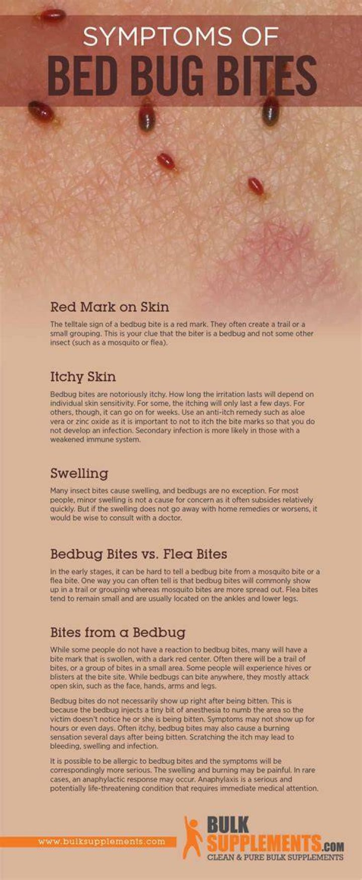 How long does bed bug bites last