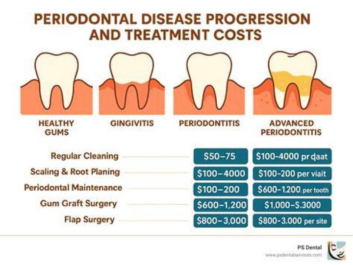 How much does periodontal treatment cost