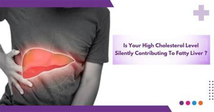 Is calf liver high in cholesterol