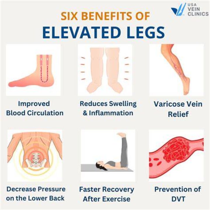 Is elevating your legs good for your heart
