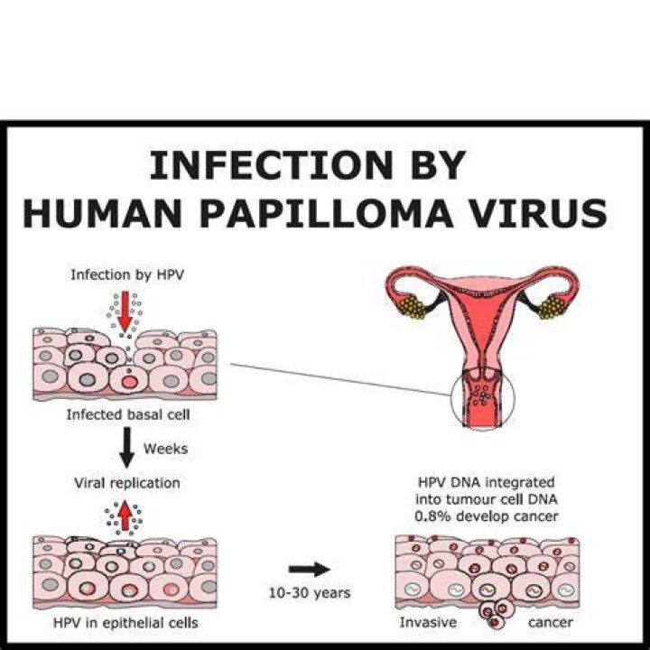 Is HPV an STD