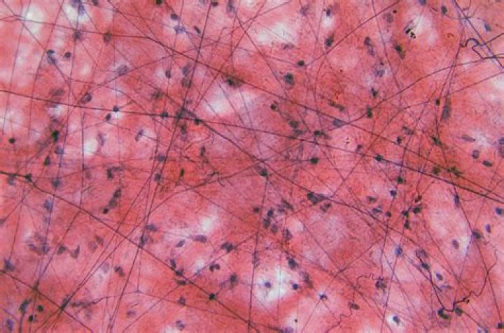 Is loose connective tissue vascular