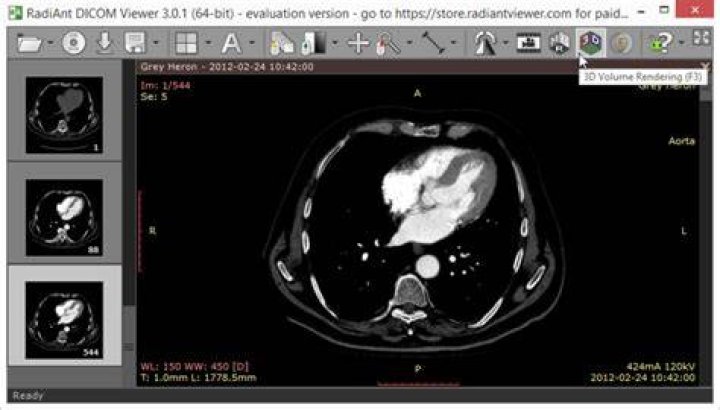 Is Radiant Dicom viewer free