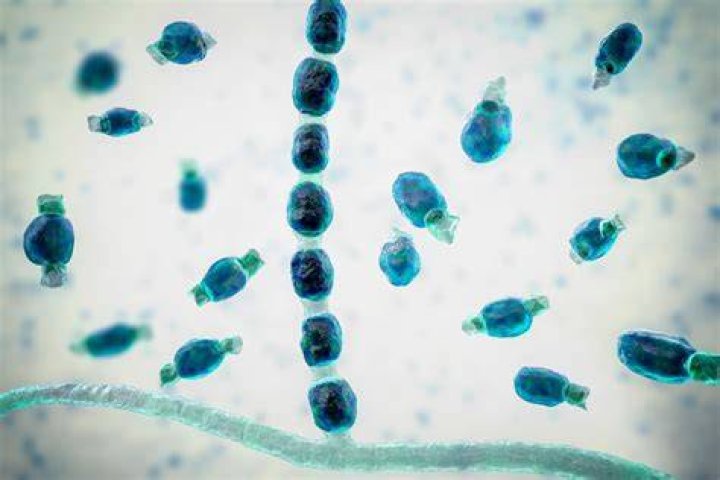 Is Valley Fever a parasite