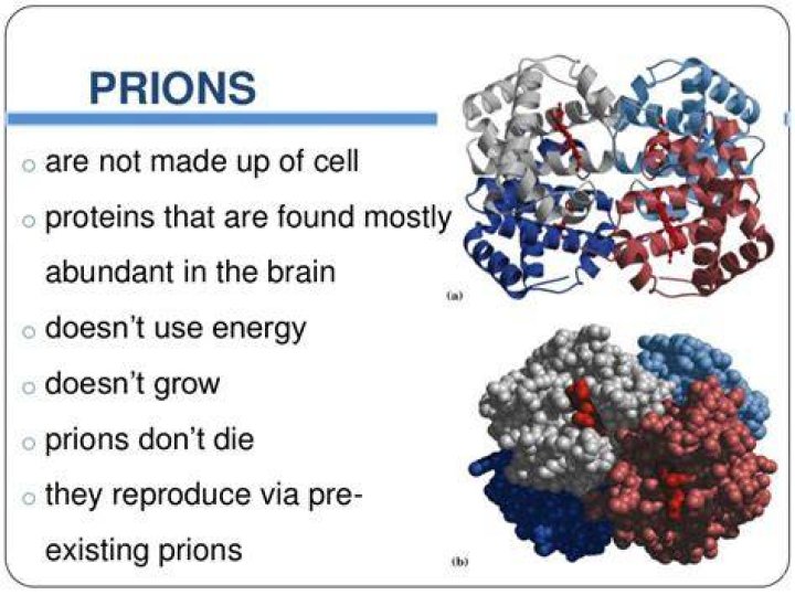 What are examples of prions