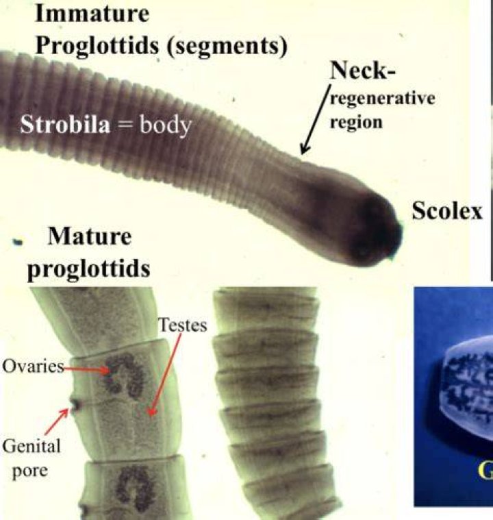 What are Proglottids