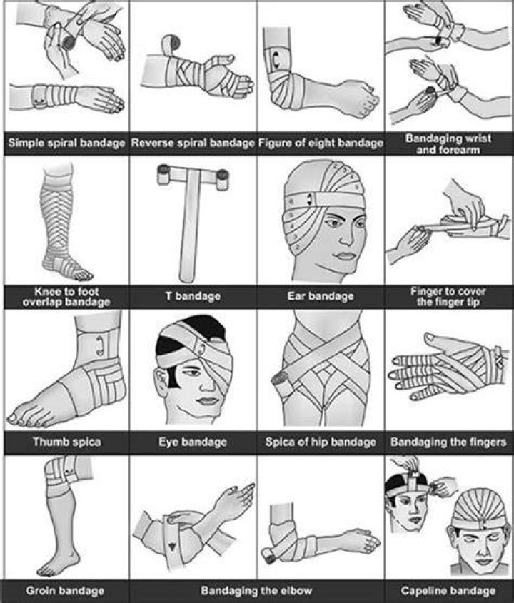 What are the different types of bandaging