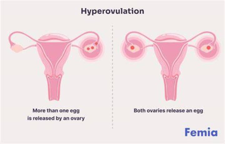 What can cause Hyperovulation