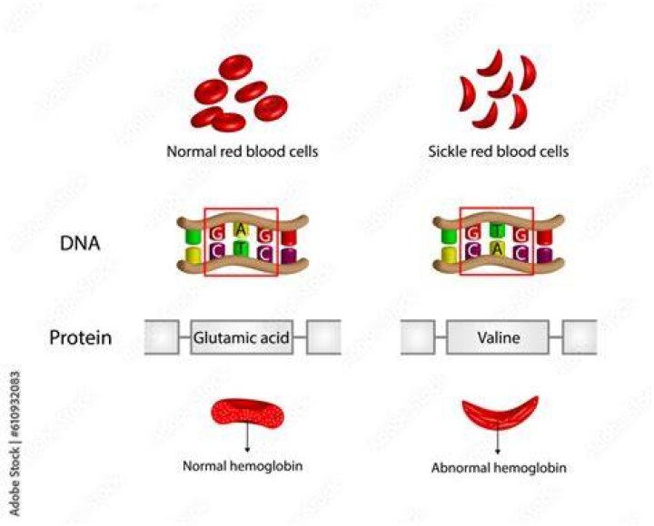What DNA changes produce sickle cell hemoglobin