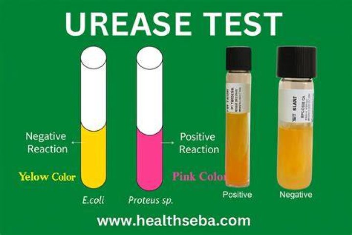 What does a positive urease test look like