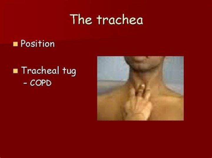 What does a tracheal tug indicate