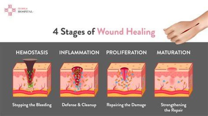 What does burning an open wound do