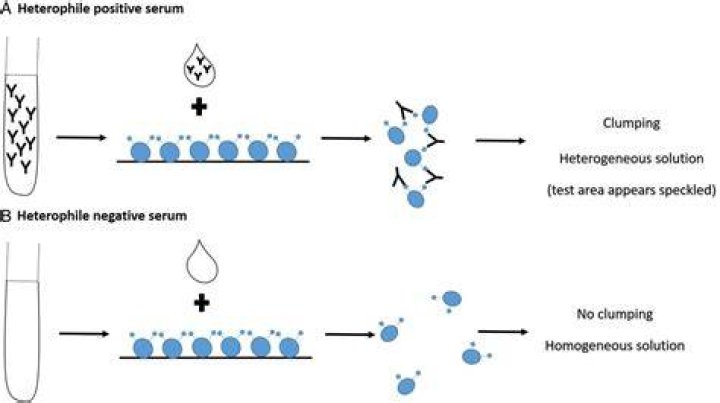 What does Heterophile antibody mean
