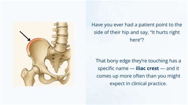 What does iliac crest pain feel like