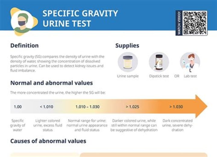 What does specific gravity of 1.000 in urine mean