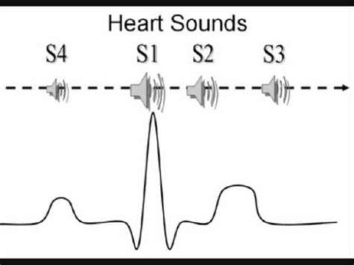 What does the 4th heart sound indicate