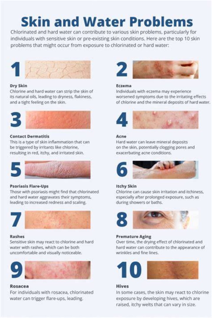 What does water do to your skin