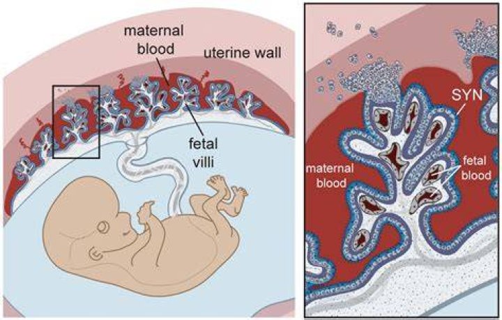 What does weak placenta mean