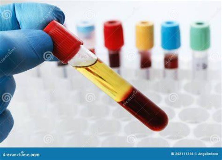 What is a serum blood test
