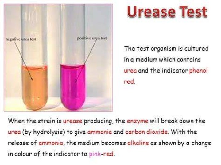 What is a urease test used for