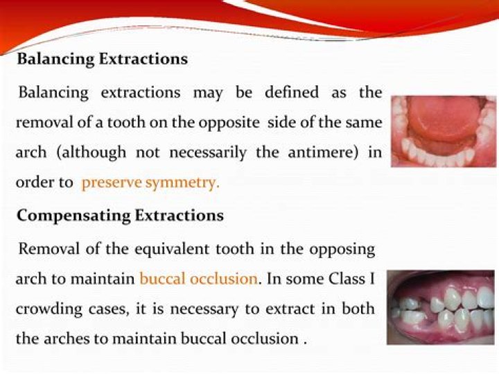 What is balancing extraction