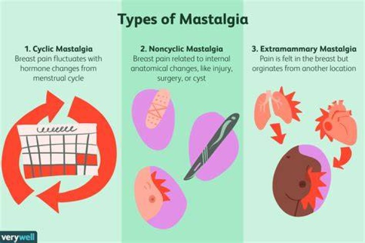 What is breast Mastalgia