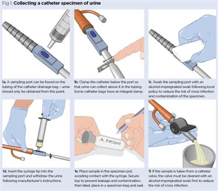 What is catheter clamping