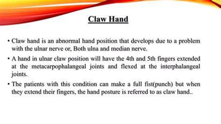 What is claw hand